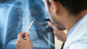 भारत में युवाओं के फेफड़े हो रहे खराब। 