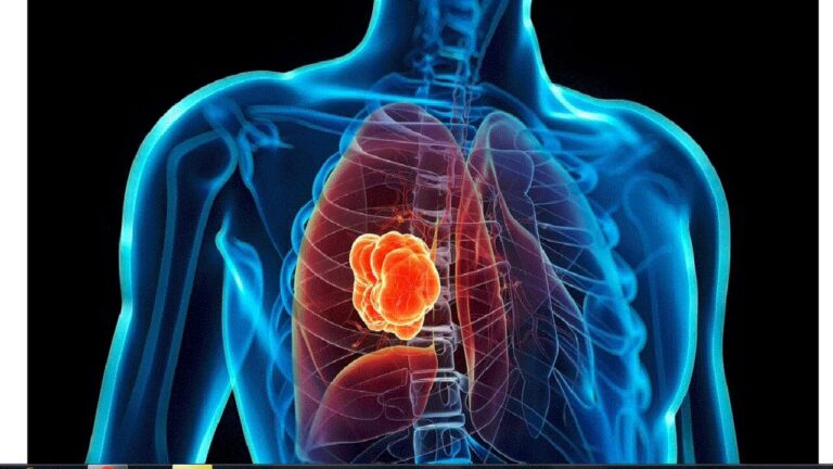 भारत में युवाओं के फेफड़े हो रहे खराब।